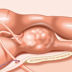 prostate chien anatomie prostatita posibil la domiciliu pentru a vindeca