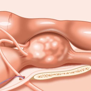 prostate chien : symptômes