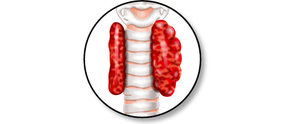 hyperthyroïdie chat forum