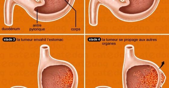 Tumeur De L Estomac Chez Le Chat Conseil Veto Illustre Catedog
