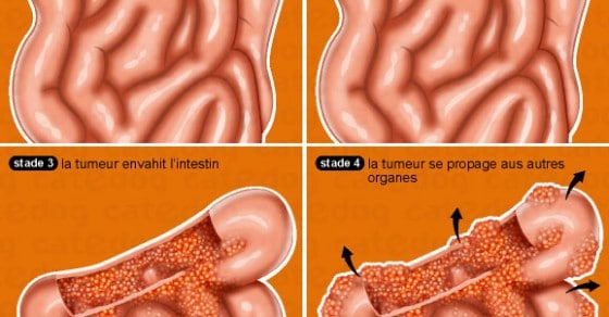 tumeur digestive chez le chat - tumeur chez le chat symptômes