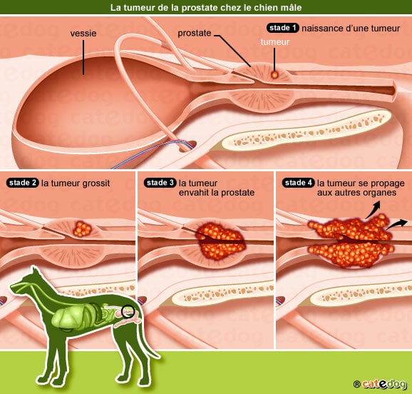 Gastric cancer ke lakshan -