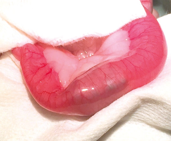 Traitement par chirurgie d'une occlusion intestinale du chat