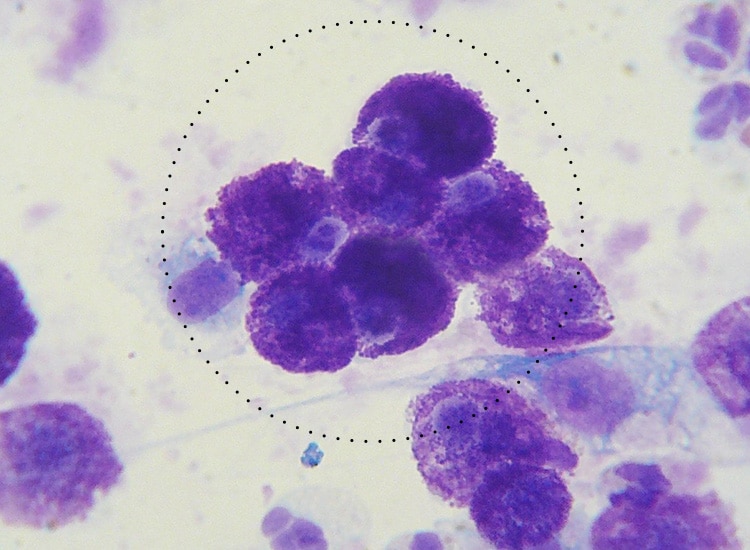 Tumeur mastocytome cutané chez le chien au microscope