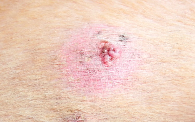 Verrue sur la peau d'un chien âgé causée par une infection à papillomavirus