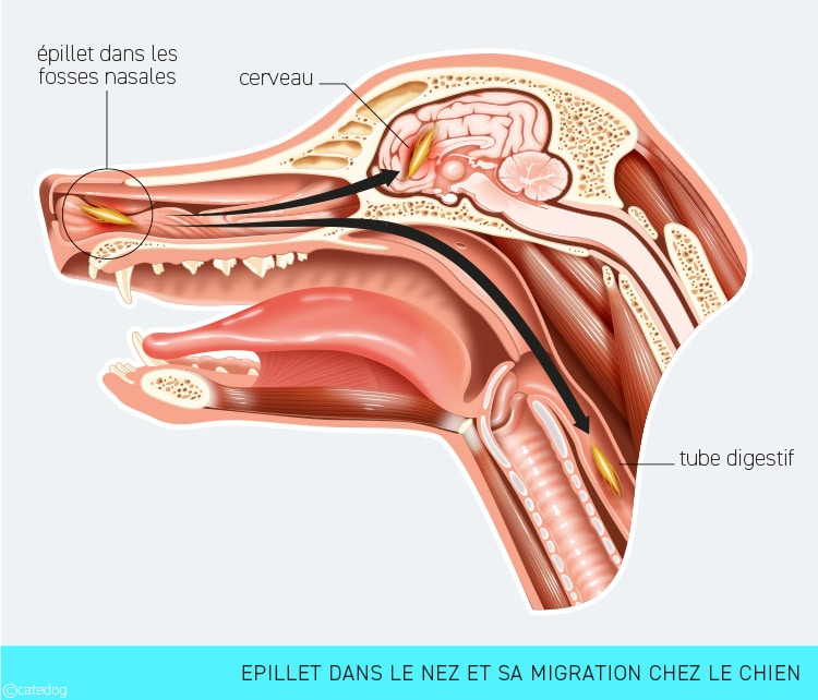 Migration d'un épillet du nez vers le cerveau chez le chien