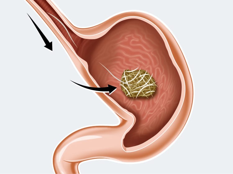 Occlusion intestinale par une boule de poils chez le chat