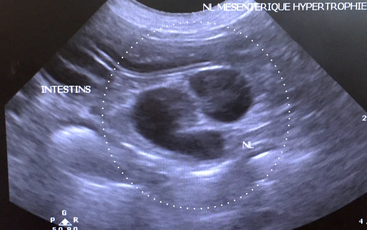 Echographie d’un lymphome chez un chien mettant en évidence une hypertrophie des ganglions mandibulaires