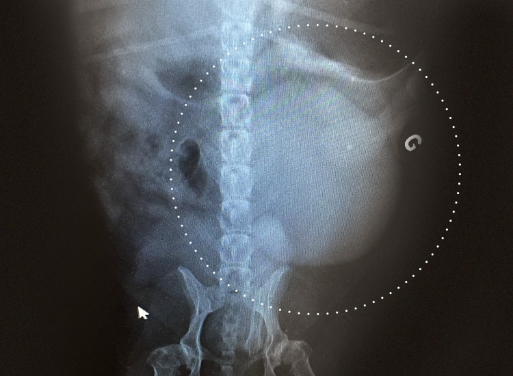 Radiographie d'une tumeur de la rate chez le chien