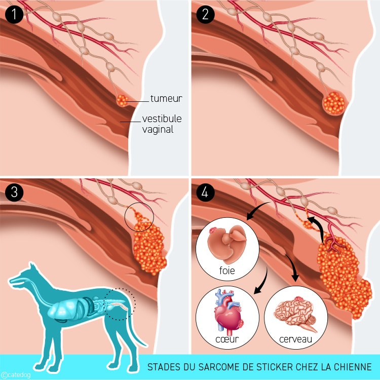 Stades de la tumeur Sarcome de Sticker chez la chienne