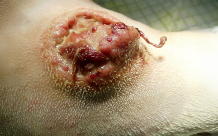 Tumeur mastocytome sur la peau d'un chat et d'un chien