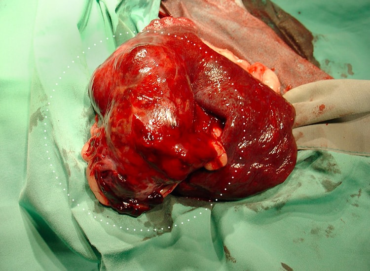 Chirurgie et retrait d'une tumeur de la rate hémangiosarcome chez le chien