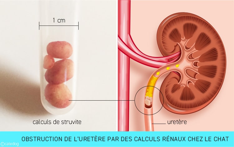 Calculs rénaux à l'origine d'une insuffisance rénale chez le chat en obstruant l'uretère