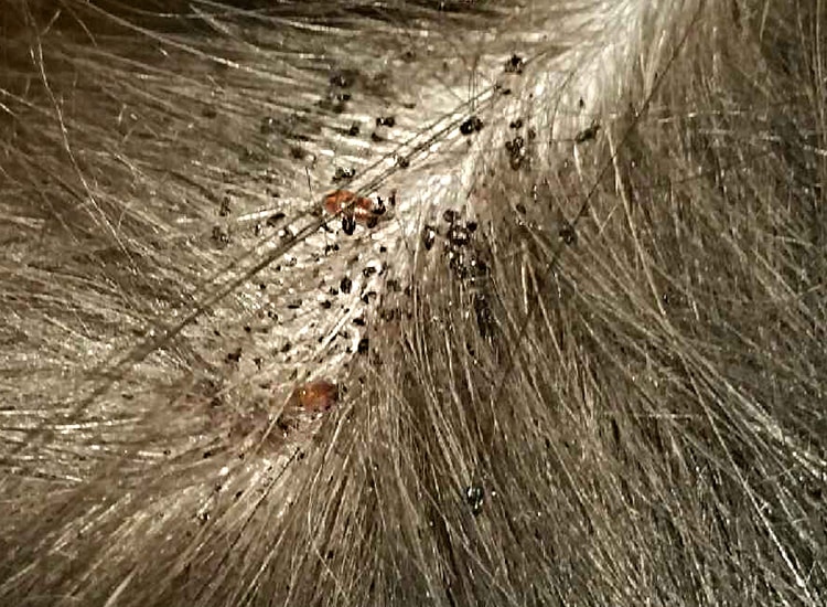 Puces et leurs crottes noires dans le pelage du chat et du chien