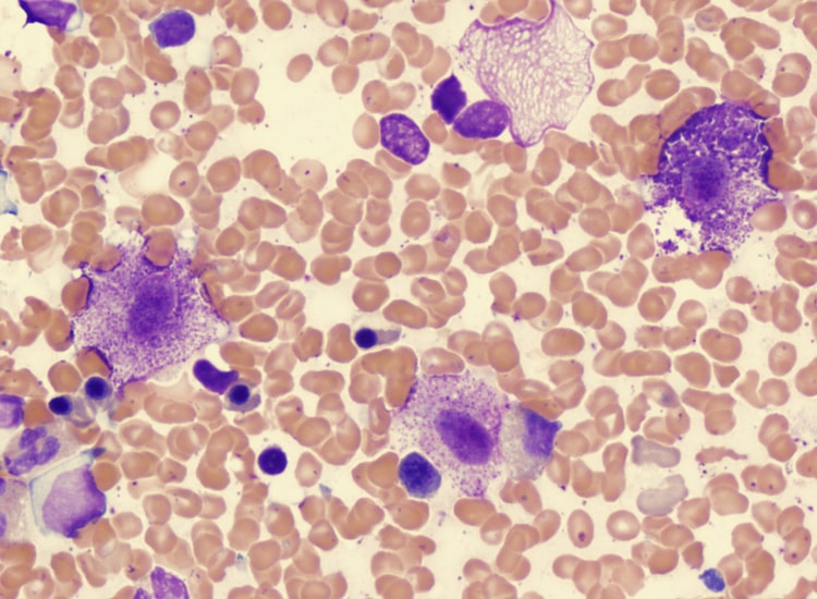 Observation de mastocytes (en violet) au microscope