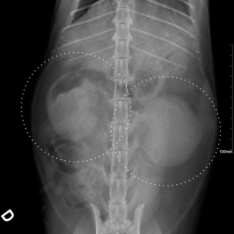 Radiographie d'un lymphome rénal chez un chat avec infiltration des deux reins par les cellules tumorales