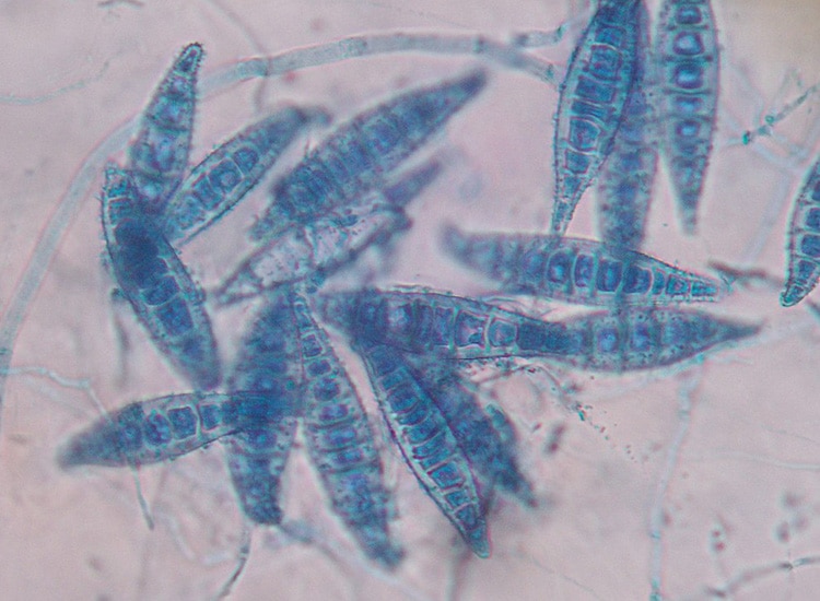 Observation au microscope de spores Microsporum canis responsables de la teigne chez le chien et le chat