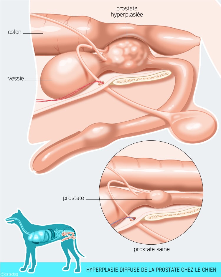 Hyperplasie diffuse de la prostate qui a grossi chez le chien