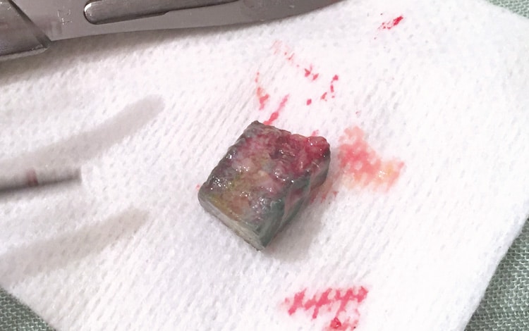 Traitement par chirurgie d'une occlusion intestinale chez le chat