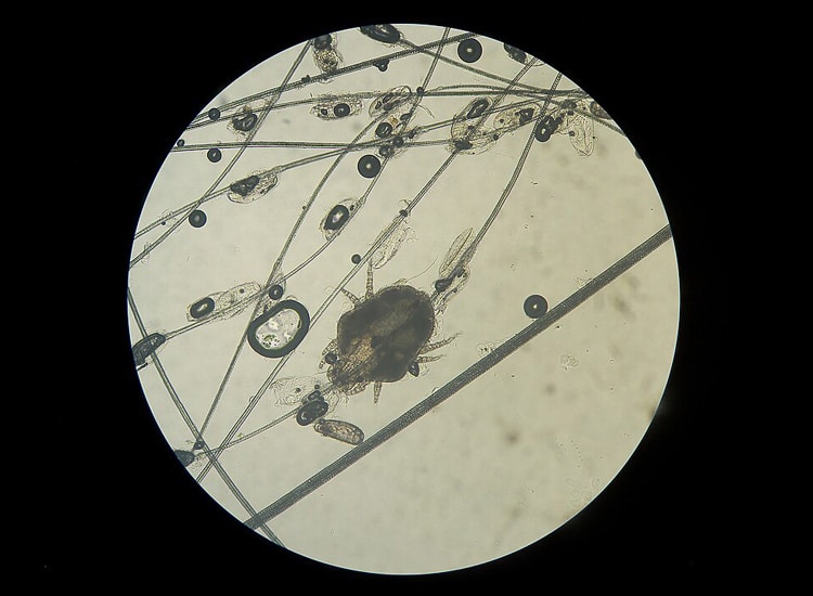 Acarien de la cheyletiellose au microscope chez le chat